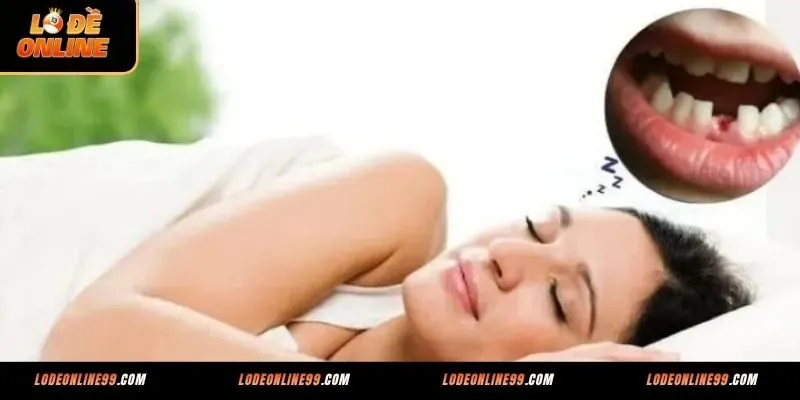 Mộng thấy rụng răng hàm trên